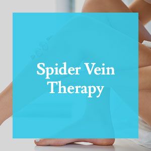 Spider Vein Therapy Before & After